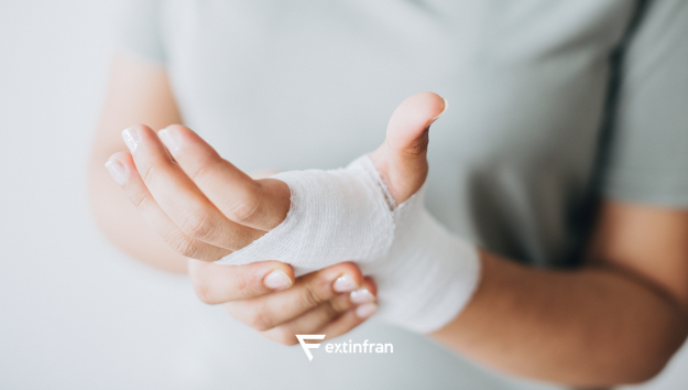 Queimaduras tipos cuidados e prevenção